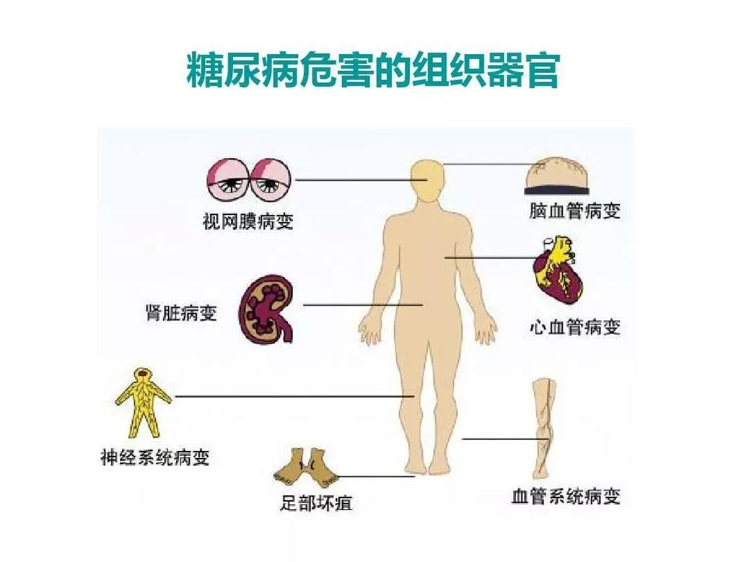 糖尿病的症状有哪些危害 上饶市向亚纯：关于糖尿病的日常科普