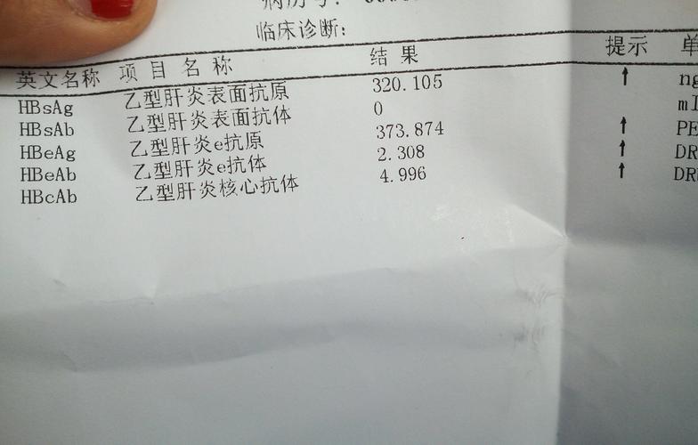 乙肝小三阳肝纤维化不治疗会恶化吗 镇江市吴凡都:关于乙肝的推荐文章