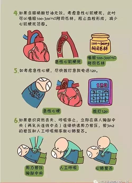 属于心绞痛的诱因有哪些 万宁市游玲燕:关于心绞痛的精选文章