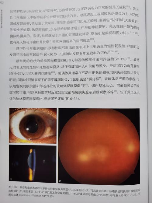 为什么蛔虫病流行广泛 遂宁市宰琼瑶：关于幼虫的知识普及
