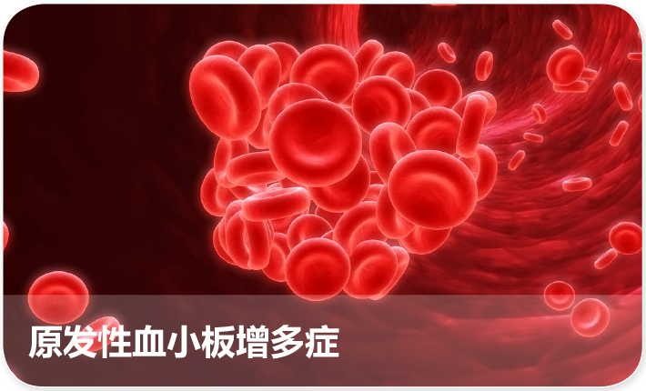 原发性血小板增多症什么意思 淮北市薛孝蓉：关于血小板的日常科普