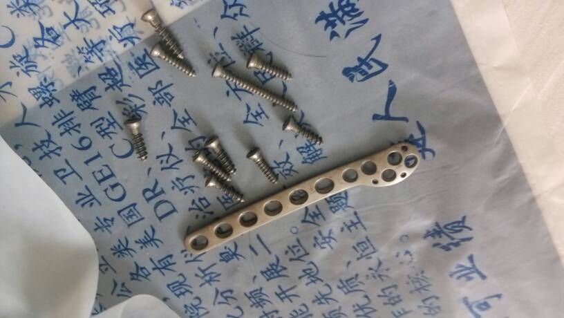 小儿骨折后吃什么东西补充营养 绵阳市都莉艺：关于钢钉的科普文章
