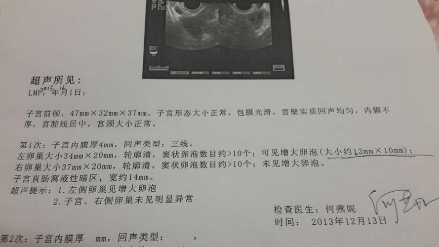 检测卵泡 威海市唐珍娣：关于卵泡的推荐文章