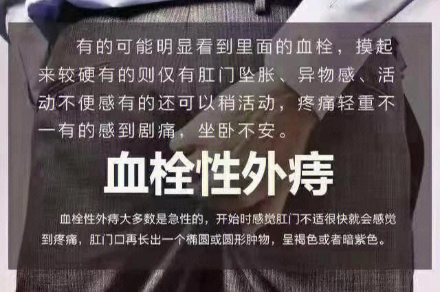 血栓性外痔疮跟普通外痔区别 西藏晋锦珍：关于外痔的专家文章