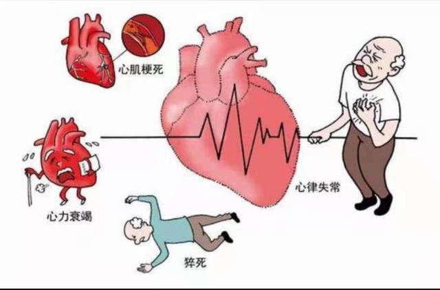 简述心肌梗死的并发症有哪些 宜春市魏园飘：关于患者的优选文章