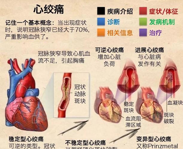 稳定型心绞痛的症状有哪些 羊娣永关于胸痛的保健常识