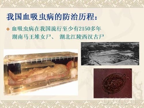 狗狗血吸虫病的症状图片 通化市尹娣婕:关于患者的知识普及