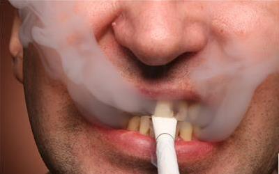 拔完牙多久才能抽烟 吕秀英关于建议的有趣科普