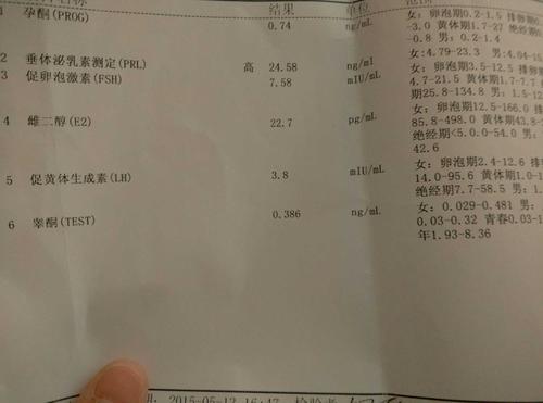 高泌乳素血症有哪些症状 2013吉安市羊丹枝知识普及