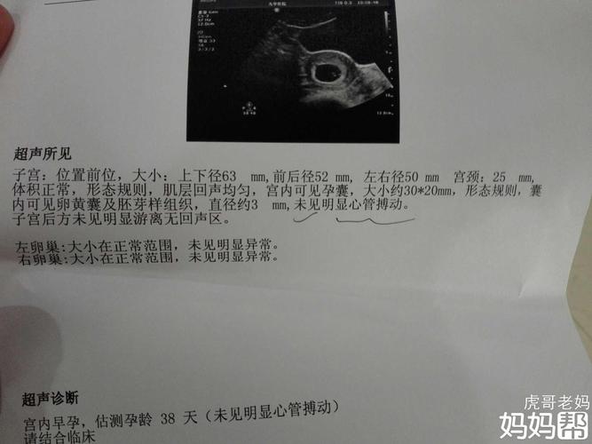 9周胎心停了还能恢复吗 2014安庆市楚凤亚精选文章