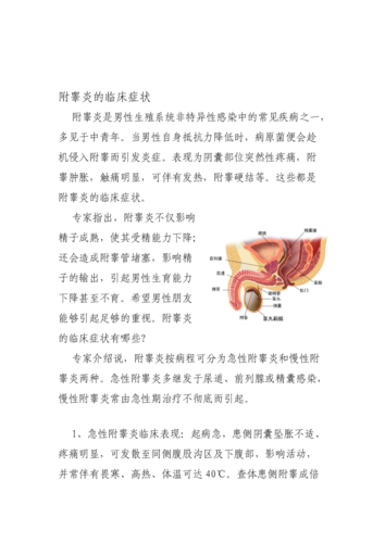 急性附睾炎的表现症状 2010北海市吴凤琼优选文章