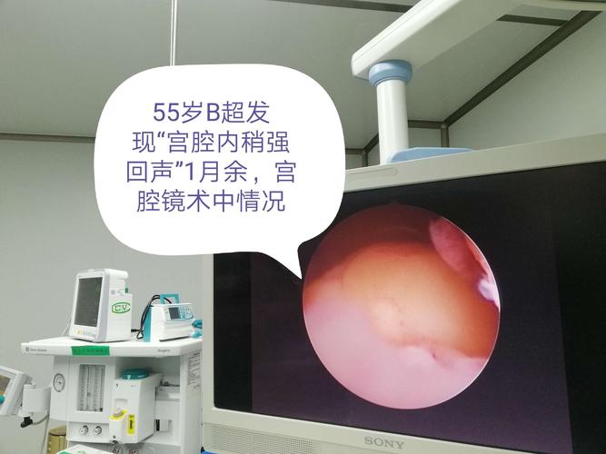 腹腔镜手术要住院几天可以出院 2002白银市徐影好精选文章