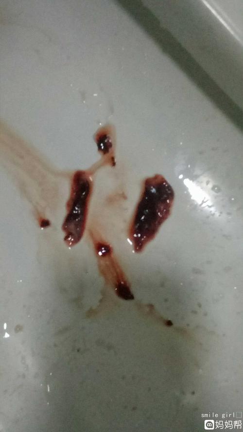 刚怀孕自然流产的症状 六盘水市狄爱英:关于自然的专家推荐