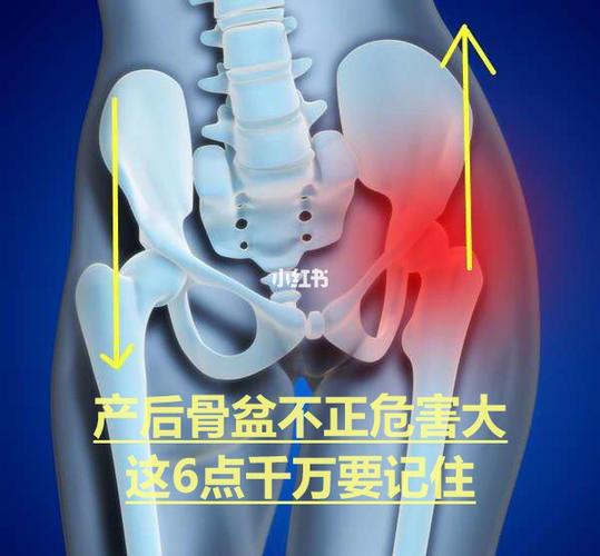产后十几年了做骨盆修复有用吗 2022阳泉市成丽育优选文章
