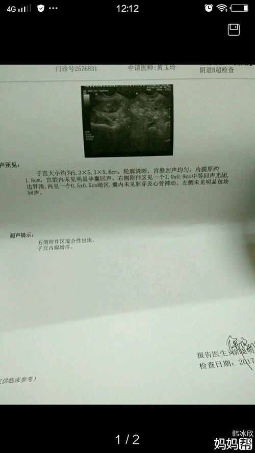 宫内还是宫外孕多久可以查出来 北海市林琼菲：关于宫外孕的科普文章