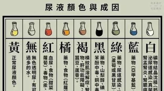 婴儿的尿液有味道吗 安康市仇锦媛：关于尿液的科普文章