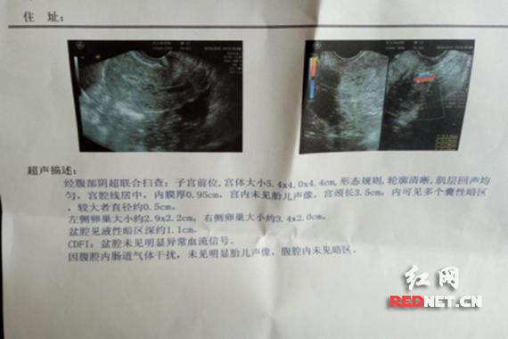 b超检查报告单怎么看 温州市黄蓉中:关于副作用的知识普及