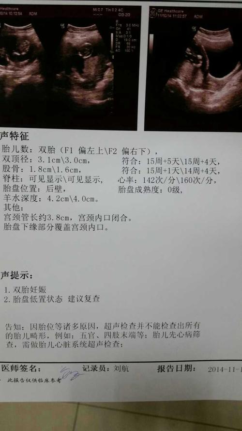 15周是几个月了 海南刁岚晶:关于胎儿的知识普及