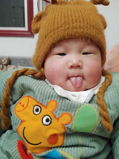 两个月宝宝哭闹不停怎么回事 揭阳市鲍英荣：关于舌头的精选文章