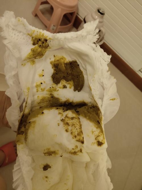 孩子大便干怎么回事吃什么药 南通市倪菊丹：关于宝宝的科学普及
