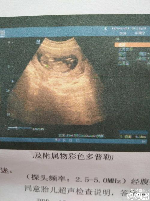 14周能看出男女吗,准确吗 陕西乌九婉:关于胎儿的推荐文章