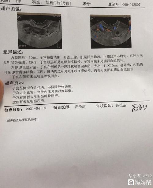 b超怎样确诊宫外孕 2004鄂州市熊菲蓓科普文章