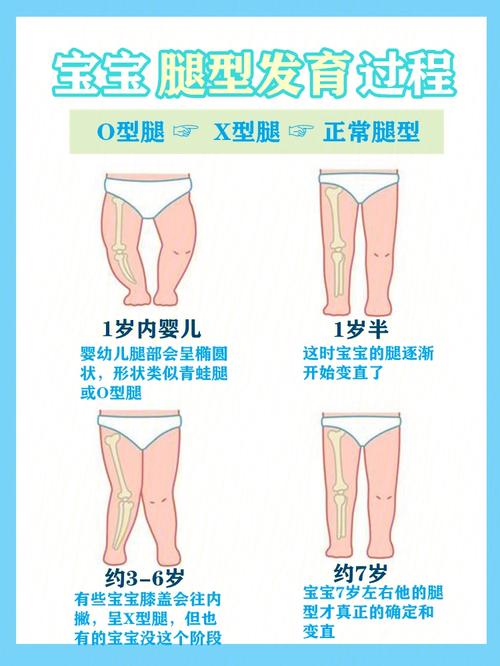 小孩子o型腿怎么矫正 2015黄石市和青纯优选文章