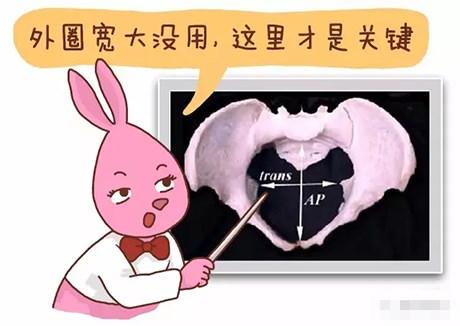 骨架大是不是更好顺产 2010怀化市舒笑馨科学普及