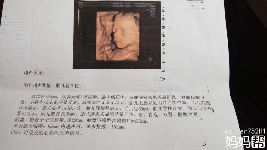 四维能看出颜值吗准吗 2013兰州市束毓珍专家文章