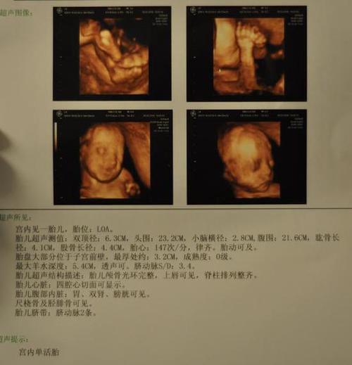 怀孕近一个月会有什么症状 2004营口市陶琬黛日常科普