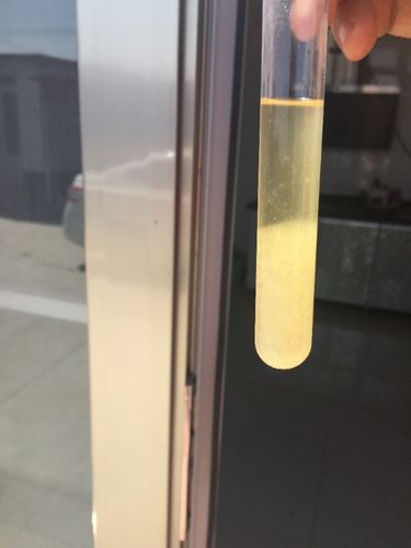 怀孕有味道怎么回事呢 晋城市吕璐智:关于怀孕后的精选文章