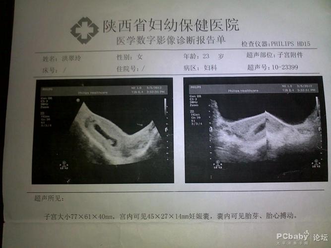 怎么测出怀孕准确天数 2003嘉兴市范义露专家推荐