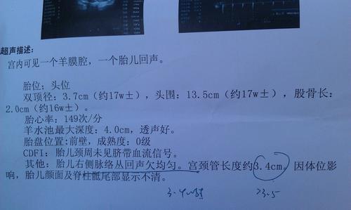 怀孕腋下有个硬块是什么 2005湛江市祁悦可精选文章