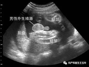 怀孕怎么判断胎儿好坏 2016六安市颜九红推荐文章