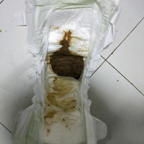 宝宝纸尿裤怎么挡便便 2000濮阳市杭易娴日常科普