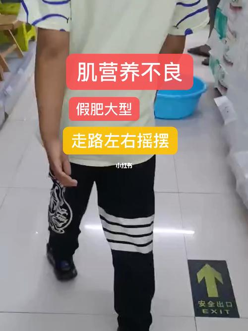 营养不良会出现走路不稳吗 安庆市封艺琴:关于营养不良的科学普及