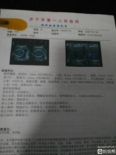 大排畸需要提前预约吗多久 吕梁市宋素荔：关于胎儿的优选文章