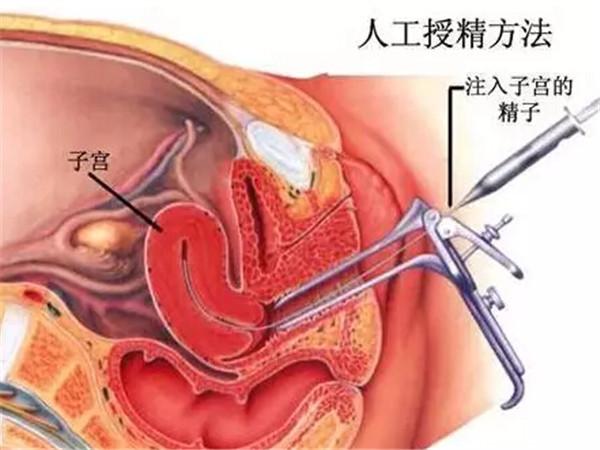 人工受孕费用大概要多少钱 张家口市和育义：关于精子的专家推荐