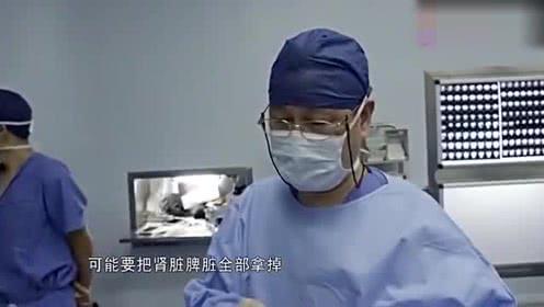 肾切除后多久可以性生活 钦州市任锦九：关于肾脏的推荐文章