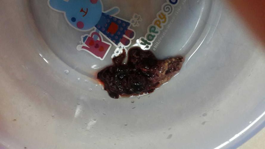 产后恶露有臭味 2021重庆市松秋好专家推荐