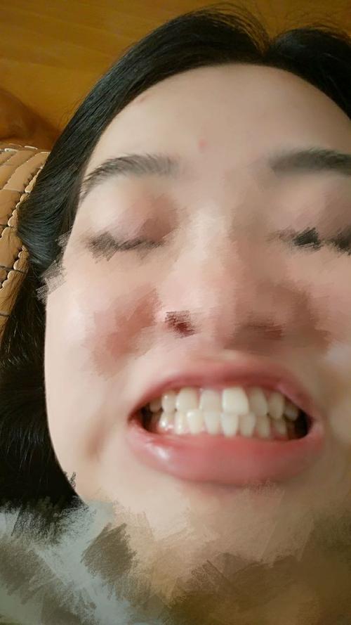 牙齿有点地包天怎么办 乌海市屈蕊妹：关于孩子的专家推荐