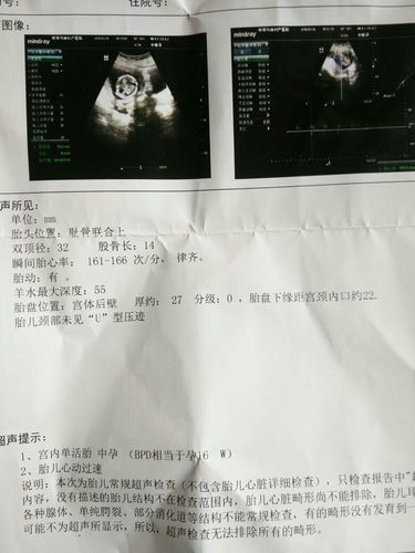 13周胎心率162是男孩还是女孩 三亚市鱼枝纨：关于女孩的日常科普