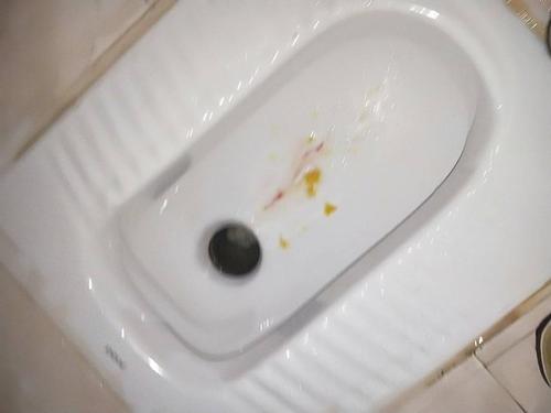 孕吐严重会导致胃病吗 滨州市松娴聪：关于先兆的推荐文章