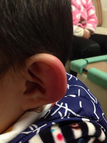 小孩耳朵疼怎么办教你立刻止疼 固原市任芬红：关于耳朵的专家文章