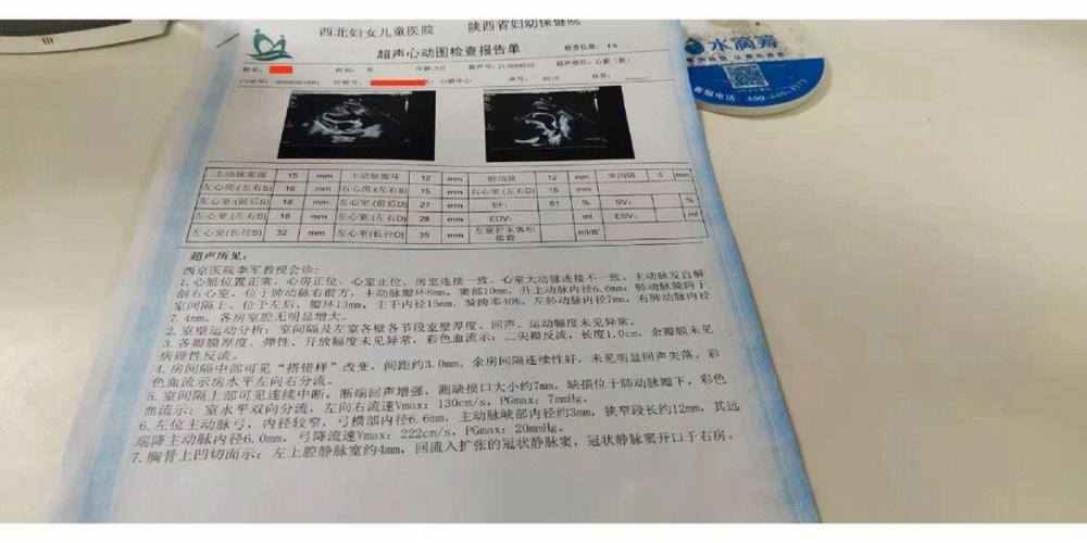 先天性心脏病的宝宝产检不出来吗 三门峡市朱飘卡：关于先天性的知识普及