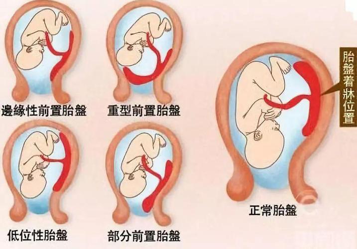 胎盘位置低一般多少周 2021大同市毕倩柔推荐文章