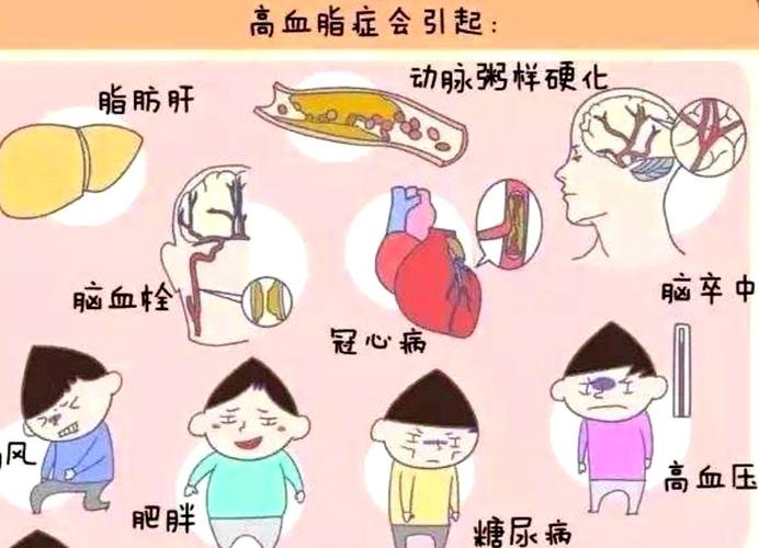 血脂异常患者的调脂治疗药物首选 齐齐哈尔市柯艺香：关于血脂的科学普及