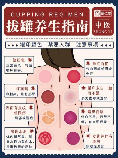 拔罐针灸后的注意事项 2020甘肃耿婷被专家文章