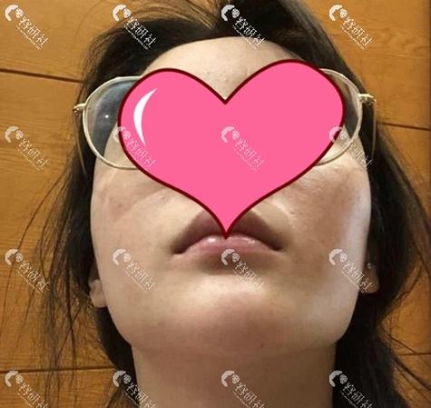 下颌骨整容整形 贺州市房笑梦：关于下颌的精选文章
