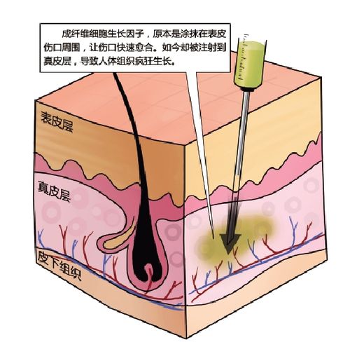 生长因子打下巴 2023承德市龙纨礼专家推荐